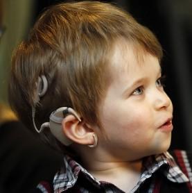 Cochlear Implant Surgery